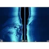 Simrad Marine Transducers|Flies</Lowrance Active Imaging 3in1